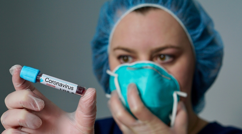 Coronavirus cases reach 30 in the country