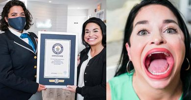 Samantha Ramsdell holds the Guinness World Record for having the largest mouth-