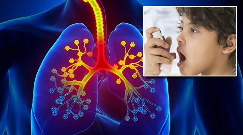 Asthma-Symptoms-Causes